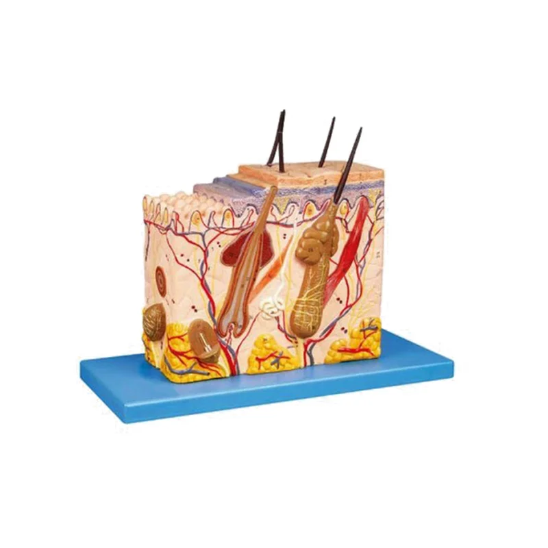 مولاژ پوست پلکانی 5469596 مولاژ پوست پلکانی 4165841968